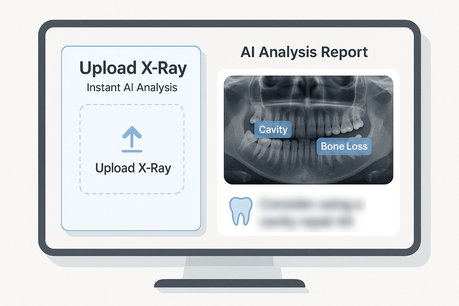 AI report preview